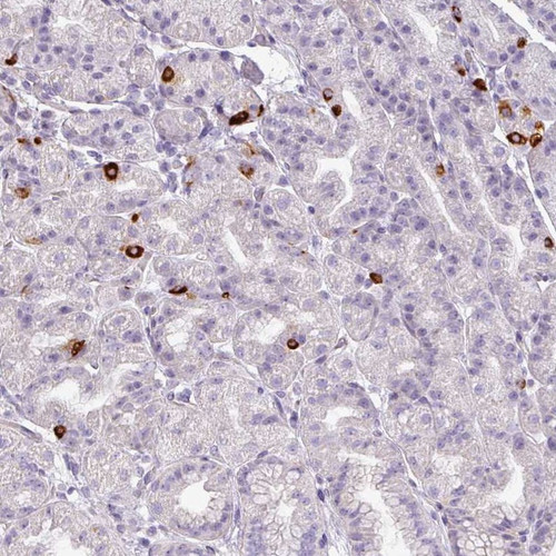 Immunohistochemical staining of human stomach, lower shows strong cytoplasmic positivity in endocrine cells.