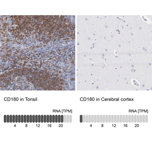 Immunohistochemistry analysis in human tonsil and cerebral cortex tissues using Anti-CD180 antibody. Corresponding CD180 RNA-seq data are presented for the same tissues.