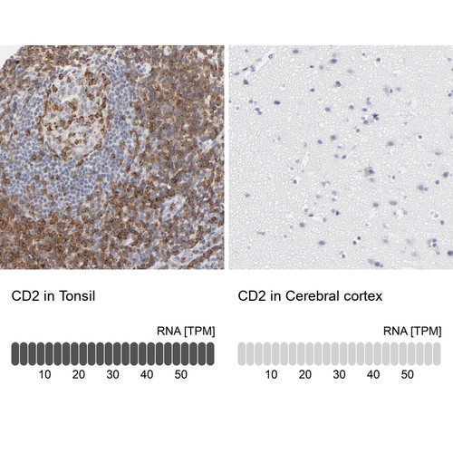 Immunohistochemistry analysis in human tonsil and cerebral cortex tissues using Anti-CD2 antibody. Corresponding CD2 RNA-seq data are presented for the same tissues.