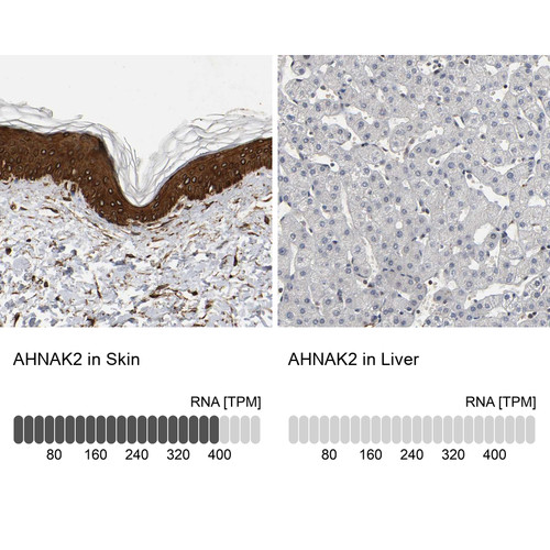 Immunohistochemistry analysis in human skin and liver tissues using Anti-AHNAK2 antibody. Corresponding AHNAK2 RNA-seq data are presented for the same tissues.