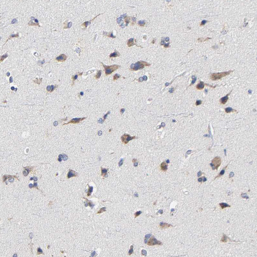 Immunohistochemical staining of human cerebral cortex shows moderate cytoplasmic positivity in neurons.