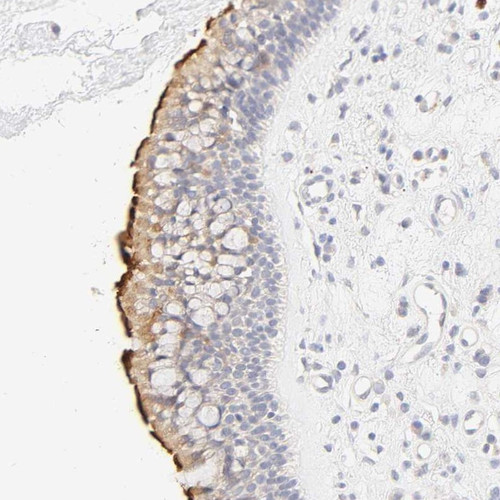 Immunohistochemical staining of human nasopharynx shows strong membranous positivity in respiratory epithelial cells.