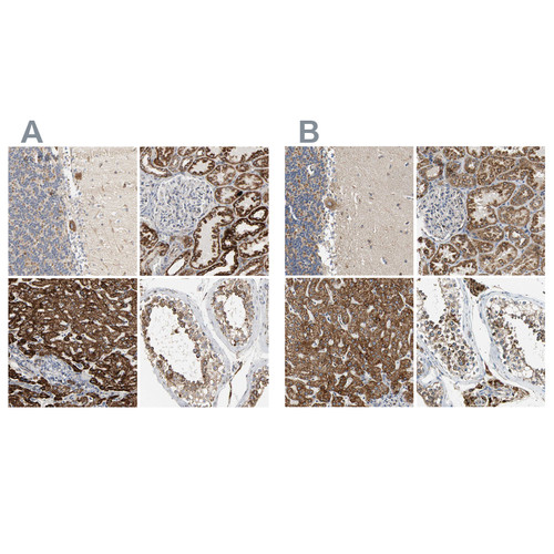 Immunohistochemical staining of human cerebellum, kidney, liver and testis using Anti-ACAT1 antibody HPA004428 (A) shows similar protein distribution across tissues to independent antibody HPA007569 (B).
