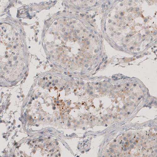 Immunohistochemical staining of human testis shows moderate cytoplasmic positivity in a subset of cells in seminiferous tubules.