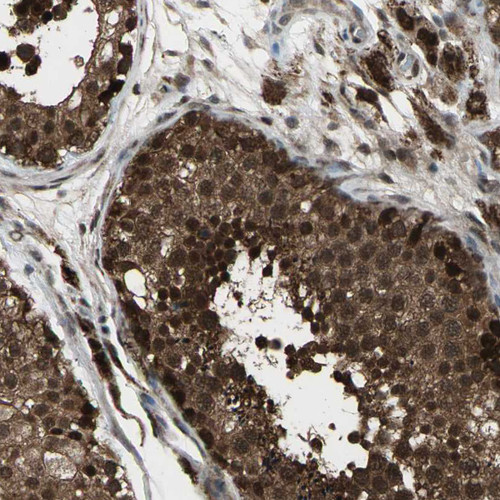 Immunohistochemical staining of human testis shows strong positivity in cells in seminiferous ducts.