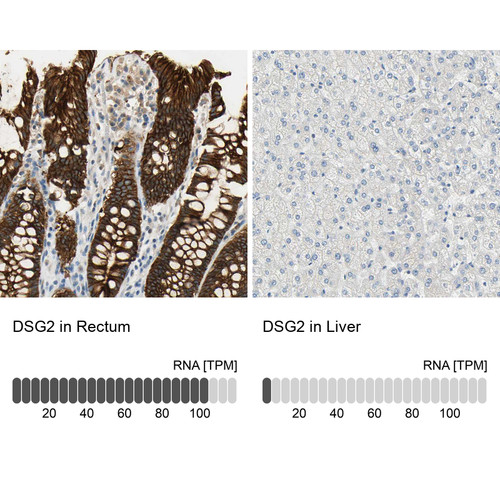 Immunohistochemistry analysis in human rectum and liver tissues using HPA004896 antibody. Corresponding DSG2 RNA-seq data are presented for the same tissues.