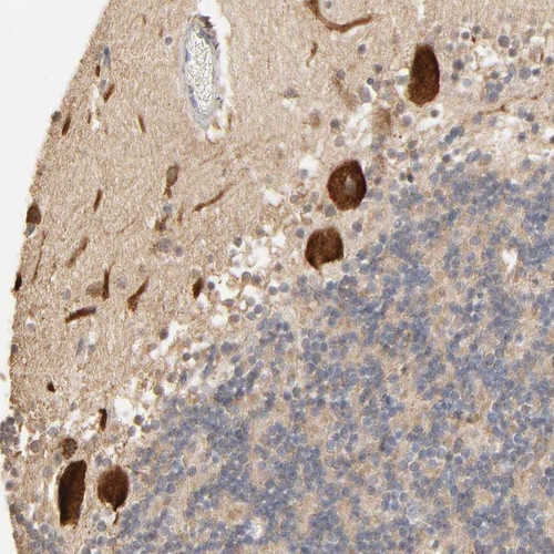 Immunohistochemical staining of human cerebellum shows strong cytoplasmic positivity in Purkinje cells.