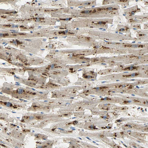 Immunohistochemical staining of human heart muscle shows strong granular cytoplasmic positivity in cardiomyocytes.
