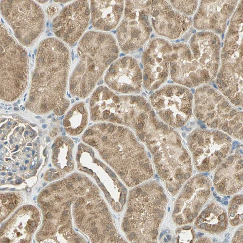 Immunohistochemical staining of human kidney shows moderate cytoplasmic positivity in cells in tubules.