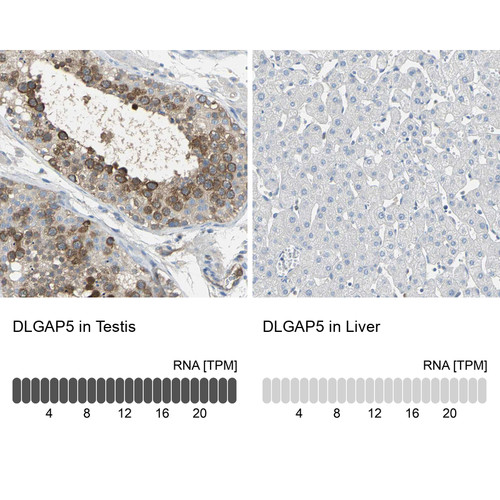 Immunohistochemistry analysis in human testis and liver tissues using HPA005546 antibody. Corresponding DLGAP5 RNA-seq data are presented for the same tissues.