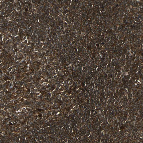 Immunohistochemical staining of human tonsil shows strong cytoplasmic positivity in germinal center cells and non-germinal center cells.