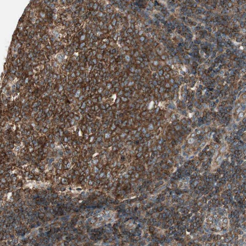 Immunohistochemical staining of human tonsil shows strong cytoplasmic positivity in reaction center cells.
