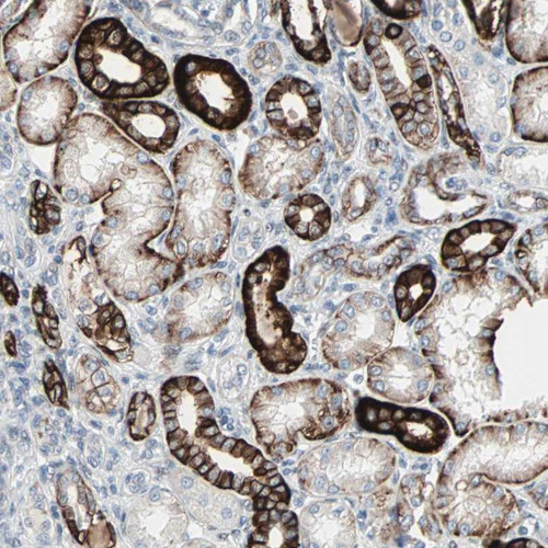 Immunohistochemical staining of human kidney shows strong cytoplasmic and membranous positivity in cells in tubules.