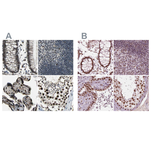 Immunohistochemical staining of human colon, lymph node, placenta and testis using Anti-ELF2 antibody HPA006057 (A) shows similar protein distribution across tissues to independent antibody HPA071166 (B).