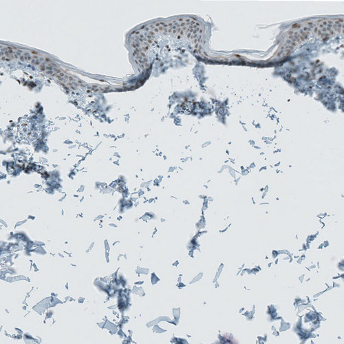 Immunohistochemical staining of human Skin shows moderate nuclear positivity in keratinocytes.