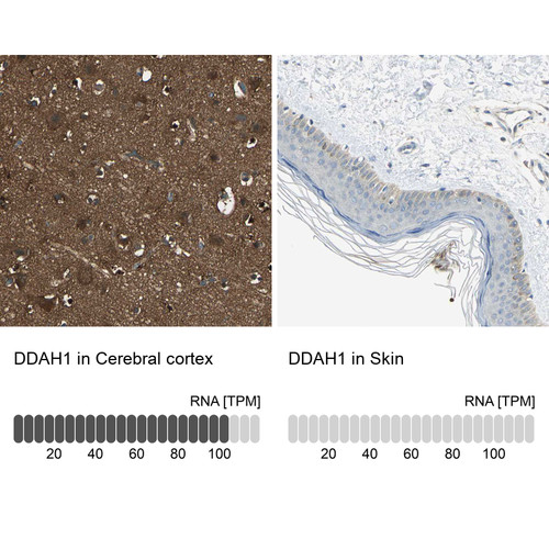 Immunohistochemistry analysis in human kidney and skin tissues using Anti-DDAH1 antibody. Corresponding DDAH1 RNA-seq data are presented for the same tissues.