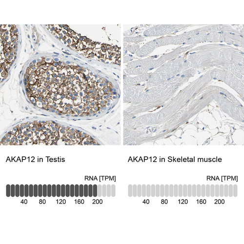Immunohistochemistry analysis in human testis and skeletal muscle tissues using HPA006344 antibody. Corresponding AKAP12 RNA-seq data are presented for the same tissues.