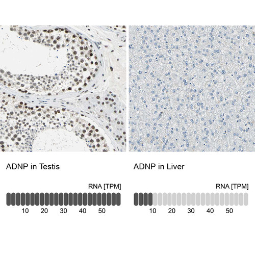 Immunohistochemistry analysis in human testis and liver tissues using HPA006371 antibody. Corresponding ADNP RNA-seq data are presented for the same tissues.