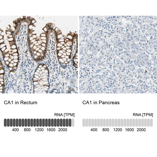 Immunohistochemistry analysis in human rectum and pancreas tissues using HPA006558 antibody. Corresponding CA1 RNA-seq data are presented for the same tissues.