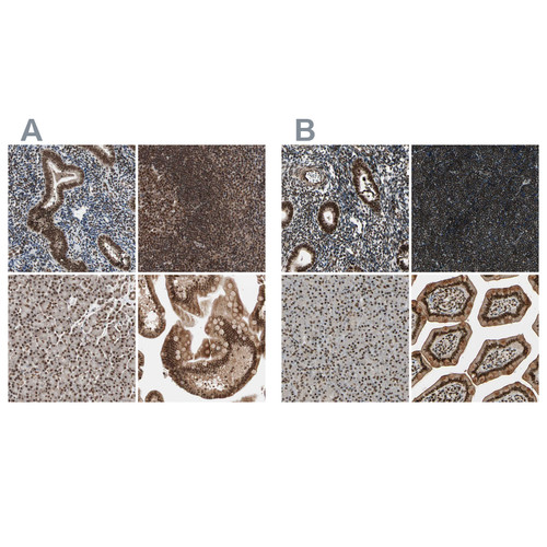 Immunohistochemical staining of human colon, kidney, lymph node and testis using Anti-CHAMP1 antibody HPA006623 (A) shows similar protein distribution across tissues to independent antibody HPA008900 (B).
