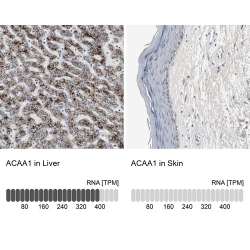 Immunohistochemistry analysis in human liver and skin tissues using HPA006764 antibody. Corresponding ACAA1 RNA-seq data are presented for the same tissues.