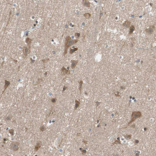Immunohistochemical staining of human Cerebral cortex shows moderate cytoplasmic positivity in neuronal cells.
