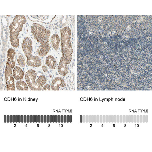 Immunohistochemistry analysis in human kidney and lymph node tissues using HPA007047 antibody. Corresponding CDH6 RNA-seq data are presented for the same tissues.