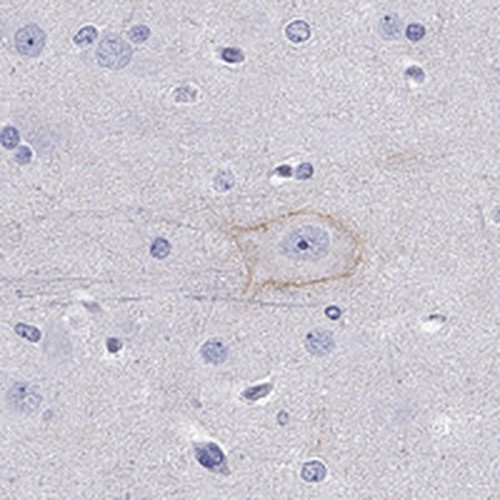 Immunohistochemical staining of human cerebral cortex shows membranous positivity in neuronal cells.
