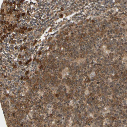 Immunohistochemical staining of human lymph node shows cytoplasmic positivity in non-germinal and germinal center.