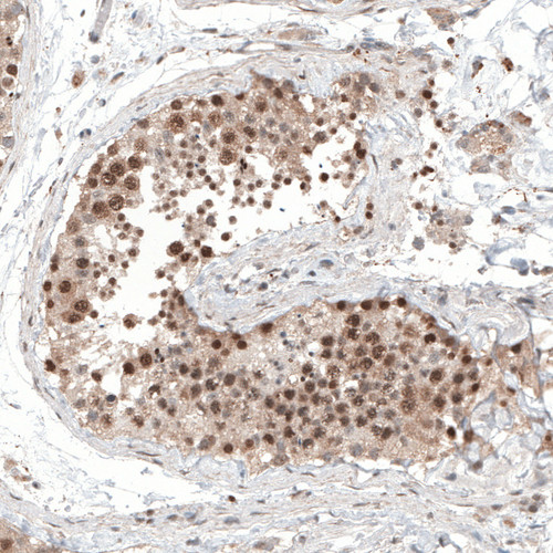 Immunohistochemical staining of human testis shows moderate to strong nuclear positivity in cells in seminiferous ducts.