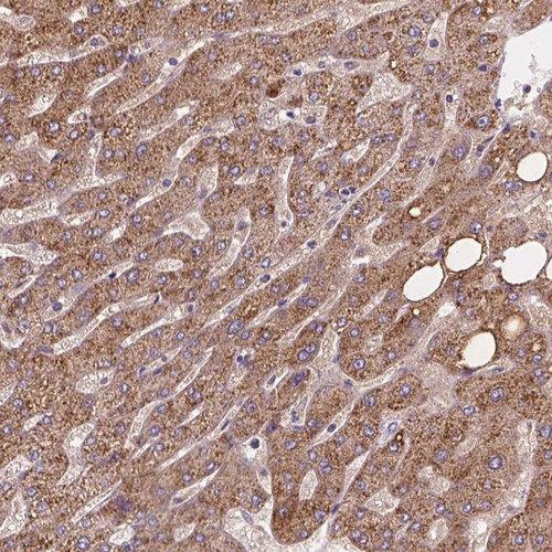 Immunohistochemical staining of human liver shows strong positivity with a granular pattern in hepatocytes.