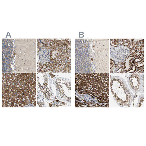 Immunohistochemical staining of human cerebellum, kidney, liver and testis using Anti-ACAT1 antibody HPA007569 (A) shows similar protein distribution across tissues to independent antibody HPA004428 (B).