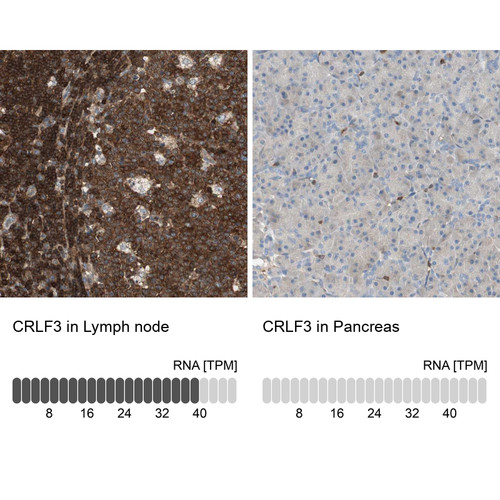 Immunohistochemistry analysis in human lymph node and pancreas tissues using Anti-CRLF3 antibody. Corresponding CRLF3 RNA-seq data are presented for the same tissues.