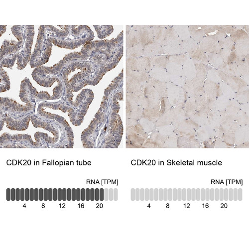 Immunohistochemistry analysis in human fallopian tube and skeletal muscle tissues using Anti-CDK20 antibody. Corresponding CDK20 RNA-seq data are presented for the same tissues.