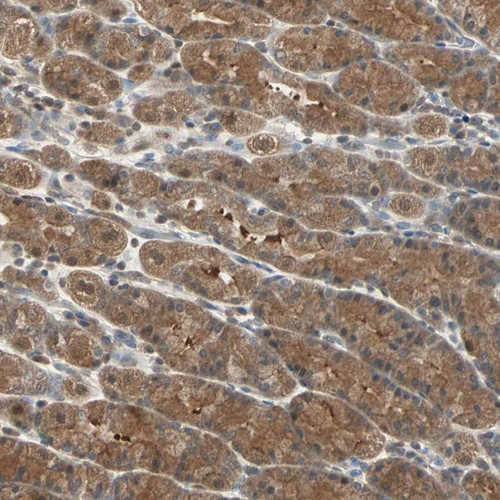 Immunohistochemical staining of human stomach shows moderate cytoplasmic positivity in glandular cells.