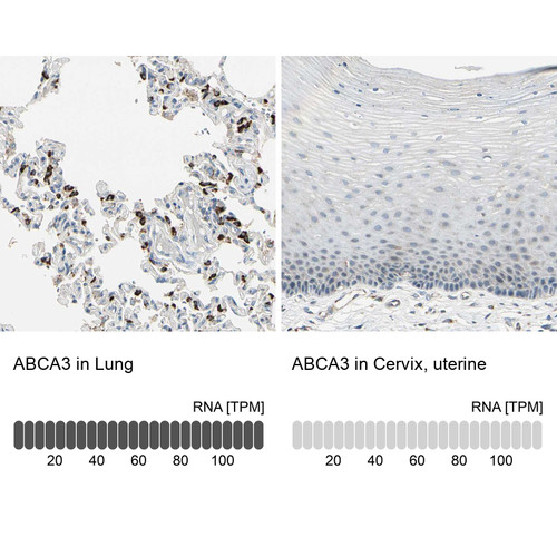 Immunohistochemistry analysis in human lung and cervix, uterine tissues using HPA007884 antibody. Corresponding ABCA3 RNA-seq data are presented for the same tissues.