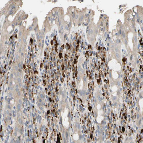 Immunohistochemical staining of human rectum shows strong cytoplasmic positivity in lymphoid cells.
