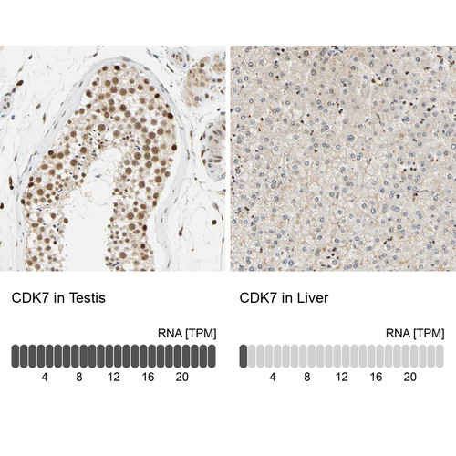 Immunohistochemistry analysis in human testis and liver tissues using HPA007932 antibody. Corresponding CDK7 RNA-seq data are presented for the same tissues.