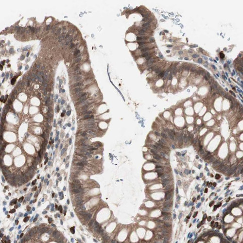 Immunohistochemical staining of human rectum shows cytoplasmic positivity in glandular cells.