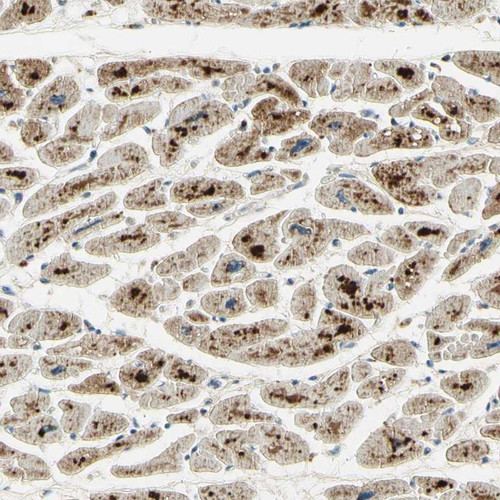 Immunohistochemical staining of human heart muscle shows strong cytoplasmic positivity in myocytes.