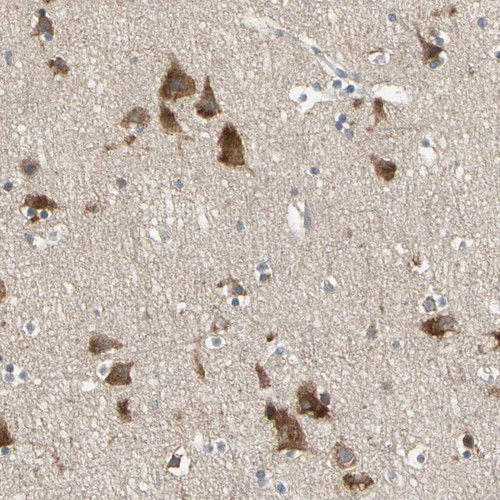 Immunohistochemical staining of human cerebral cortex shows strong cytoplasmic positivity in neuronal cells.
