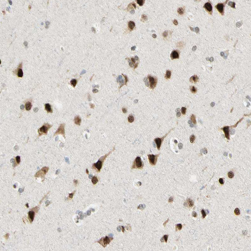 Immunohistochemical staining of human cerebral cortex shows strong nuclear positivity in neuronal cells.