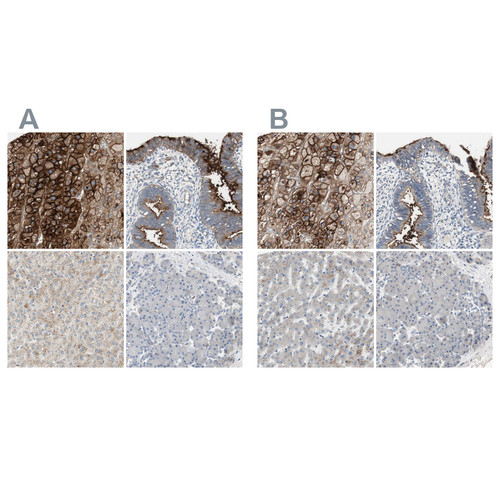 Immunohistochemical staining of human adrenal gland, endometrium, liver and pancreas using Anti-ALPL antibody HPA008765 (A) shows similar protein distribution across tissues to independent antibody HPA007105 (B).