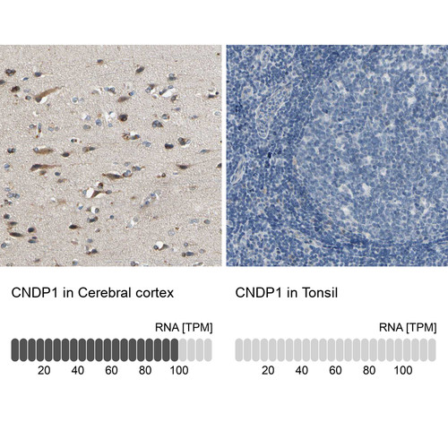 Immunohistochemistry analysis in human cerebral cortex and tonsil tissues using HPA008933 antibody. Corresponding CNDP1 RNA-seq data are presented for the same tissues.
