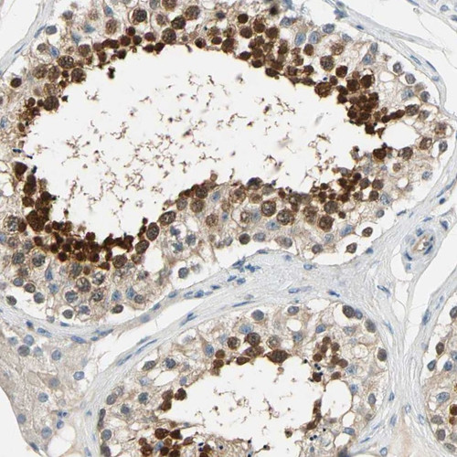 Immunohistochemical staining of human testis shows strong cytoplasmic positivity in cells in seminiferous ducts.