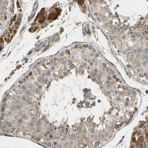 Immunohistochemical staining of human testis shows strong cytoplasmic positivity in Leydig cells while moderate positivity in cells in seminiferous ducts.