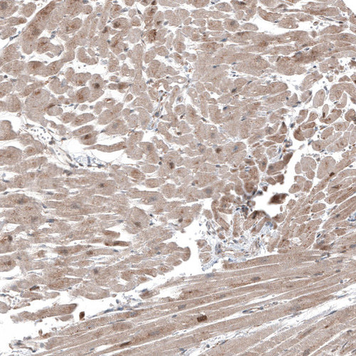 Immunohistochemical staining of human Heart muscle shows moderate cytoplasmic positivity in cardiomyocytes.