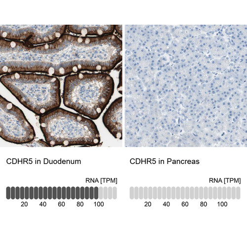 Immunohistochemistry analysis in human duodenum and pancreas tissues using HPA009173 antibody. Corresponding CDHR5 RNA-seq data are presented for the same tissues.