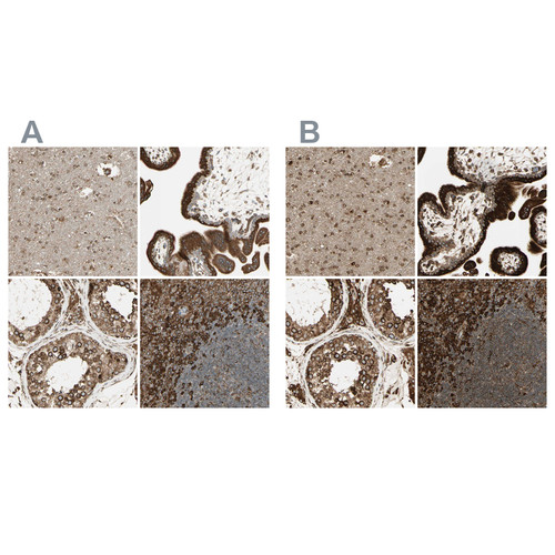 Immunohistochemical staining of human cerebral cortex, placenta, testis and tonsil using Anti-CANX antibody HPA009696 (A) shows similar protein distribution across tissues to independent antibody HPA009433 (B).
