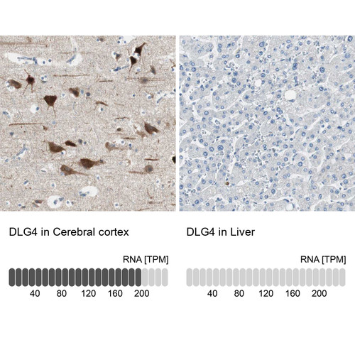 Immunohistochemistry analysis in human cerebral cortex and liver tissues using Anti-DLG4 antibody. Corresponding DLG4 RNA-seq data are presented for the same tissues.